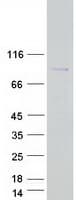 Human CCDC120 Protein (Recombinant Myc-DDK (Flag))