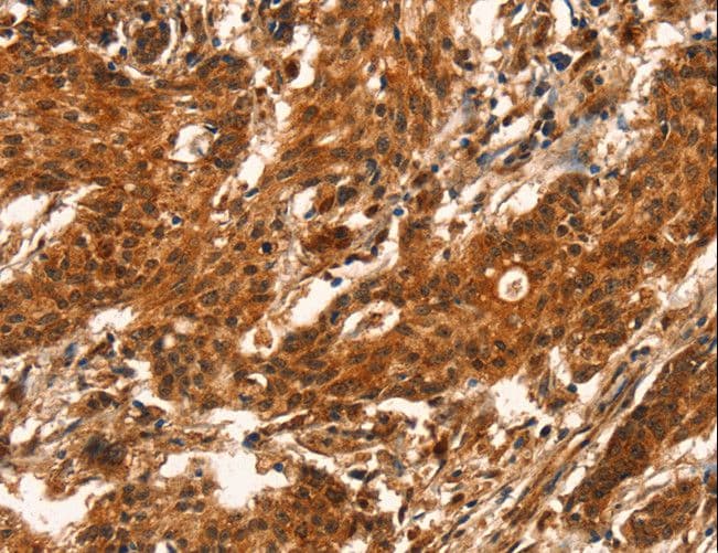 Polyclonal Rabbit anti-Human CUEDC2 Antibody (IHC, WB)