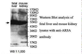 ARSA / Arylsulfatase A Antibody (aa301-493)