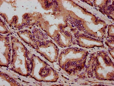 IBA57 / C1orf69 Antibody