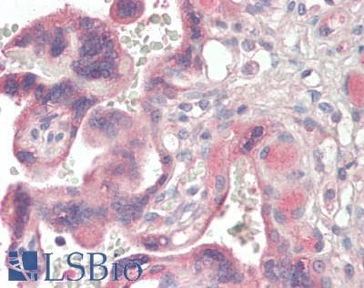 IHC-plus™ Polyclonal Goat anti-Human BMP1 Antibody (IHC, WB)