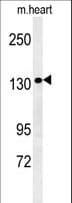 BRCTD1 / ANKRD32 Antibody (aa159-188)