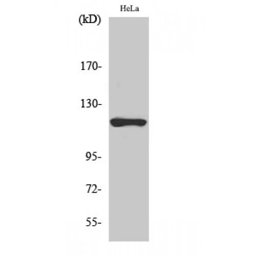 HK1 / Hexokinase 1 Antibody (1-80 aa, N-terminal)