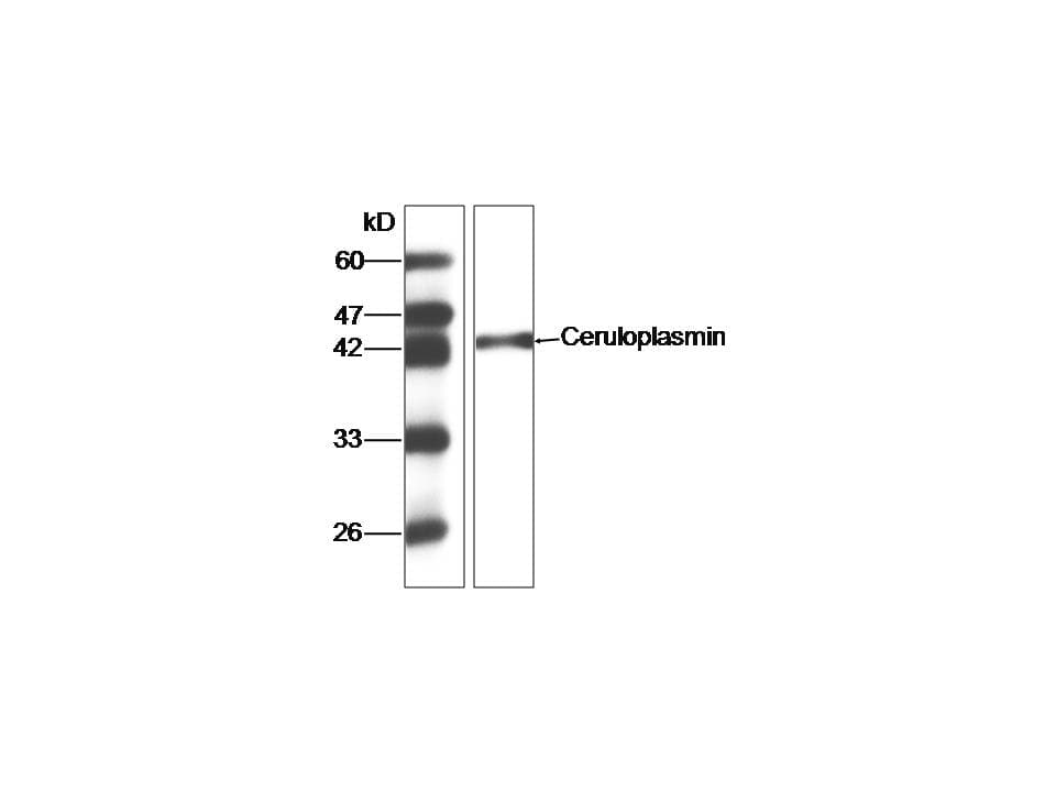 CP / Ceruloplasmin Antibody (aa933-1065, clone 2)