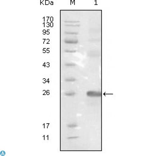 EPHB3 / EPH Receptor B3 Antibody