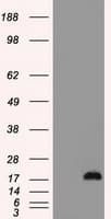 CTAG1B / NY-ESO-1 Antibody (clone OTI2B6)