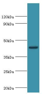 TDG / Thymine DNA Glycosylase Antibody (aa141-410)