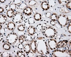 Monoclonal Mouse anti-Human LTA4H / LTA4 Antibody (clone OTI6B5, IHC, WB)