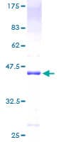 Human NIP45 / NFATC2IP Protein (Recombinant GST)