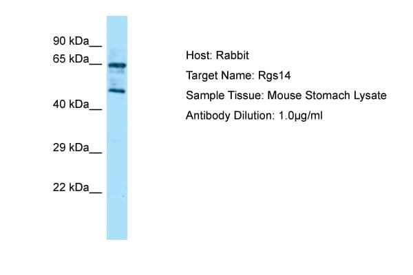 RGS14 Antibody (aa201-250)
