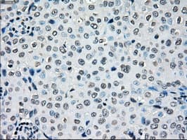 BRAF / B-Raf Antibody (clone OTI5A9)