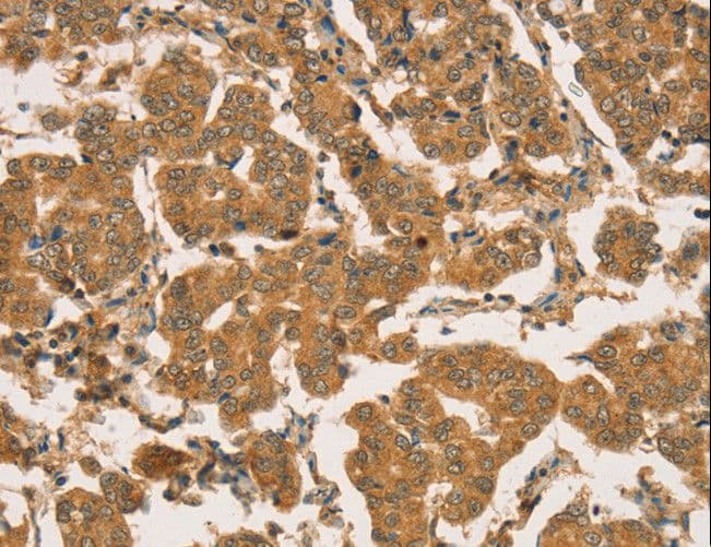 Polyclonal Rabbit anti-Human RBBP8 / CTIP Antibody (IHC)