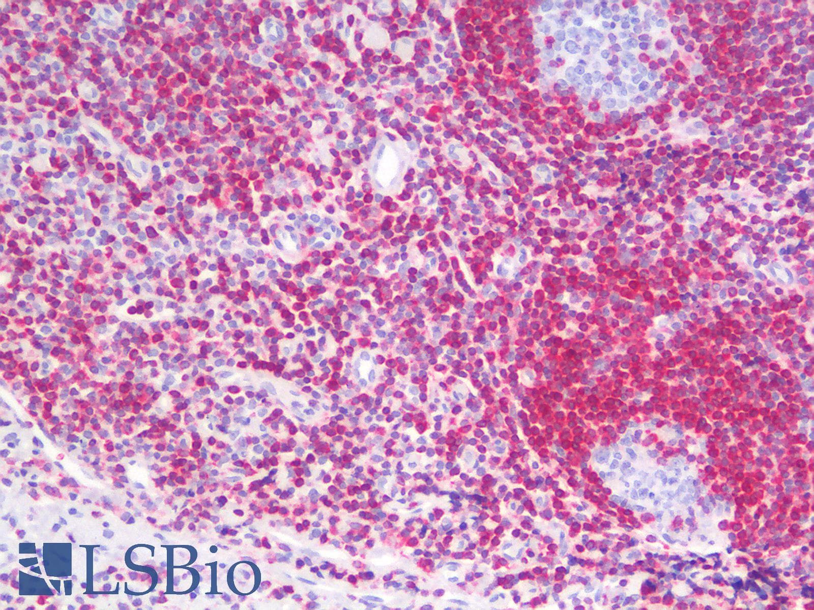PathPlus™ BCL2 / Bcl-2 Antibody (clone rBCL2/782)
