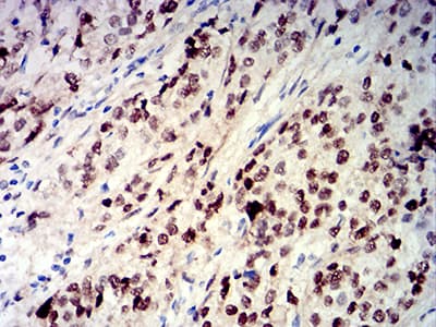 Monoclonal Mouse anti-Human CIRP / CIRBP Antibody (clone 6E12D5, IHC, WB)