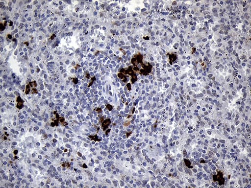 Monoclonal Mouse anti-Human RACGAP1 / MGCRACGAP Antibody (clone OTI3D8, aa123-238, IHC, WB)