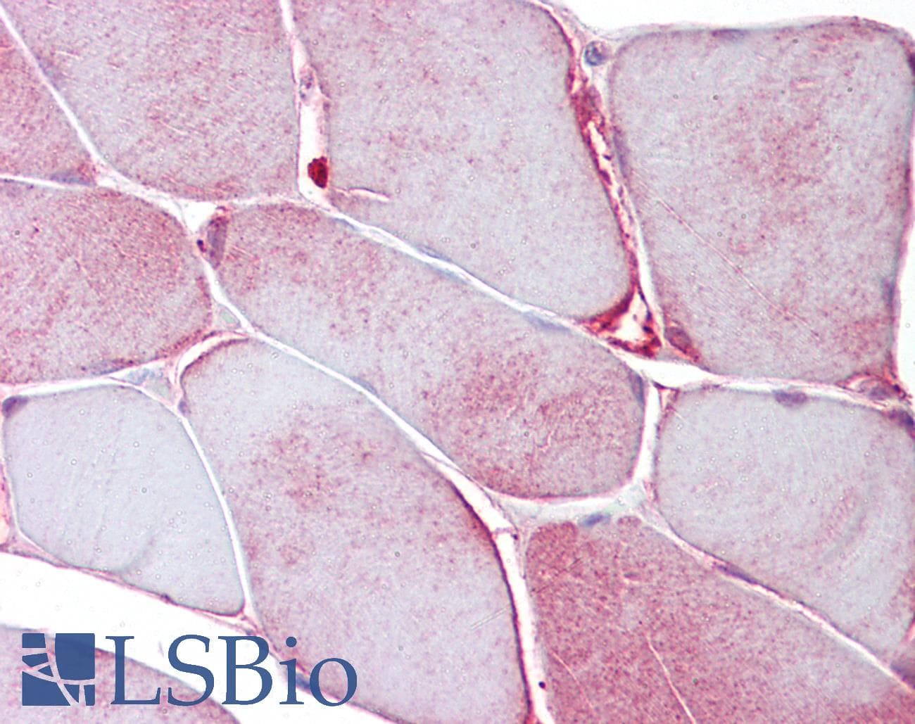 IHC-plus™ ALDOA / Aldolase A Antibody (aa66-95)
