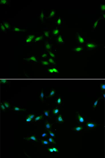 MDM2 Antibody