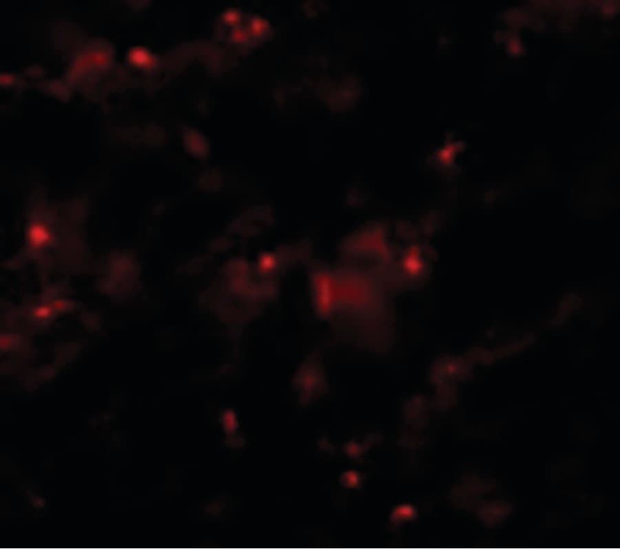 PathPlus™ Polyclonal Rabbit anti-Human AXIN2 / Axin 2 Antibody (IHC, IF, WB)