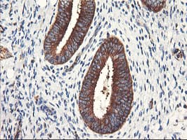 PFKP Antibody (clone OTI1F2)