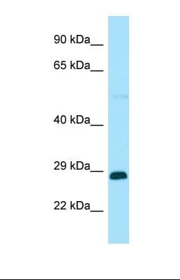 Polyclonal Rabbit anti-Human RABGAP1L Antibody (aa456-505, WB)
