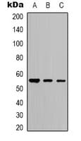 TUBB3 / Tubulin Beta 3 Antibody