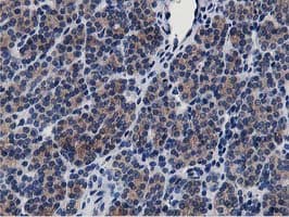 Monoclonal Mouse anti-Human ATG3 Antibody (clone OTI2C12, IHC, IF, WB)