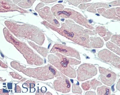 IHC-plus™ Polyclonal Rabbit anti-Mouse MT-ND2 Antibody (IHC, WB)