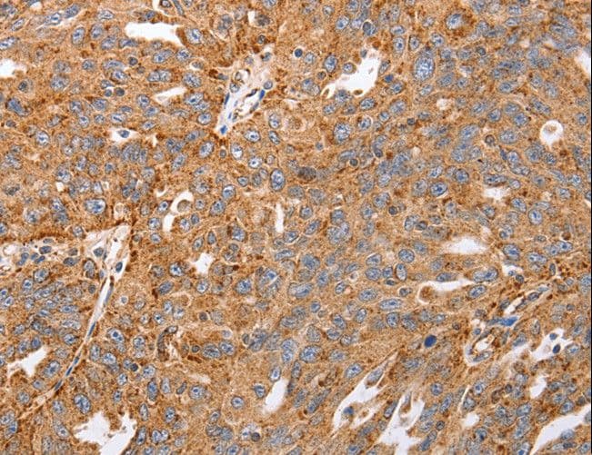MAP2K5 / MEK5 Antibody