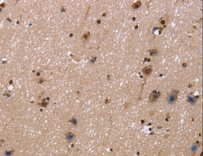 Polyclonal Rabbit anti-Human FASTKD5 Antibody (IHC)