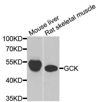 GCK / Glucokinase Antibody