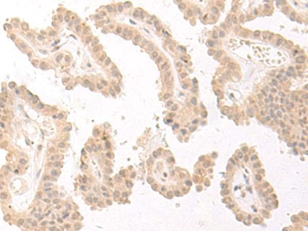 PBXIP1 / HPIP Antibody