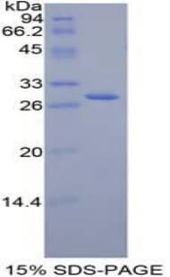 Mouse JAG2 / Jagged-2 Protein (Recombinant His-T7)