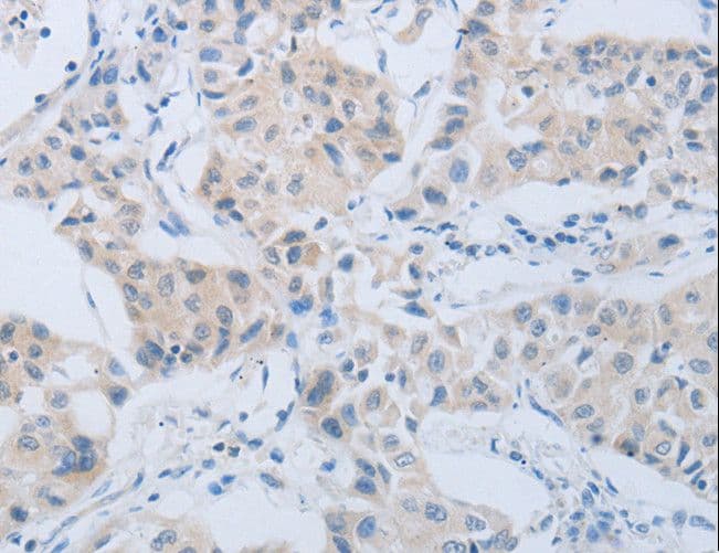 Polyclonal Rabbit anti-Human MME / CD10 Antibody (IHC, WB)