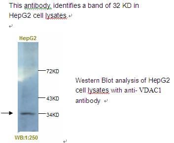 IHC-plus™ VDAC1 / PORIN Antibody