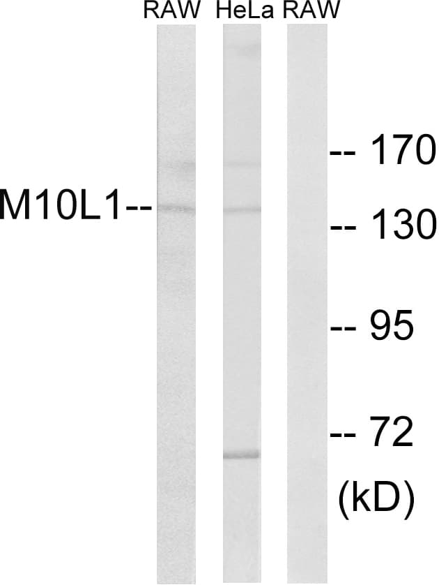 MOV10L1 Antibody (aa318-367)