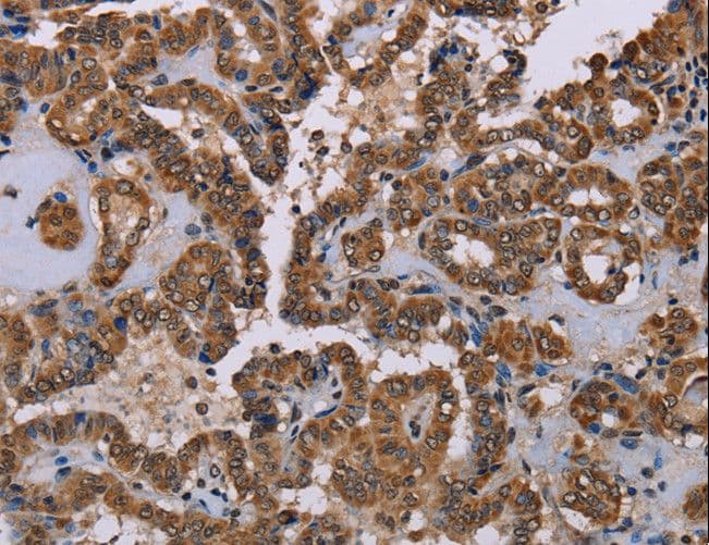 Polyclonal Rabbit anti-Human Rhodopsin Kinase / GRK1 Antibody (IHC)