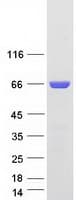 Human COASY Protein (Recombinant Myc-DDK (Flag))