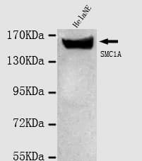 Monoclonal Mouse anti-Human SMC1A / SMC1 Antibody (N-Terminus, IHC, WB)