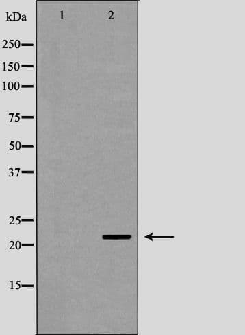 Polyclonal Rabbit anti-Human UBE2K / LIG Antibody (IHC, WB)