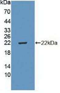 CDKN2D / p19 INK4d Antibody