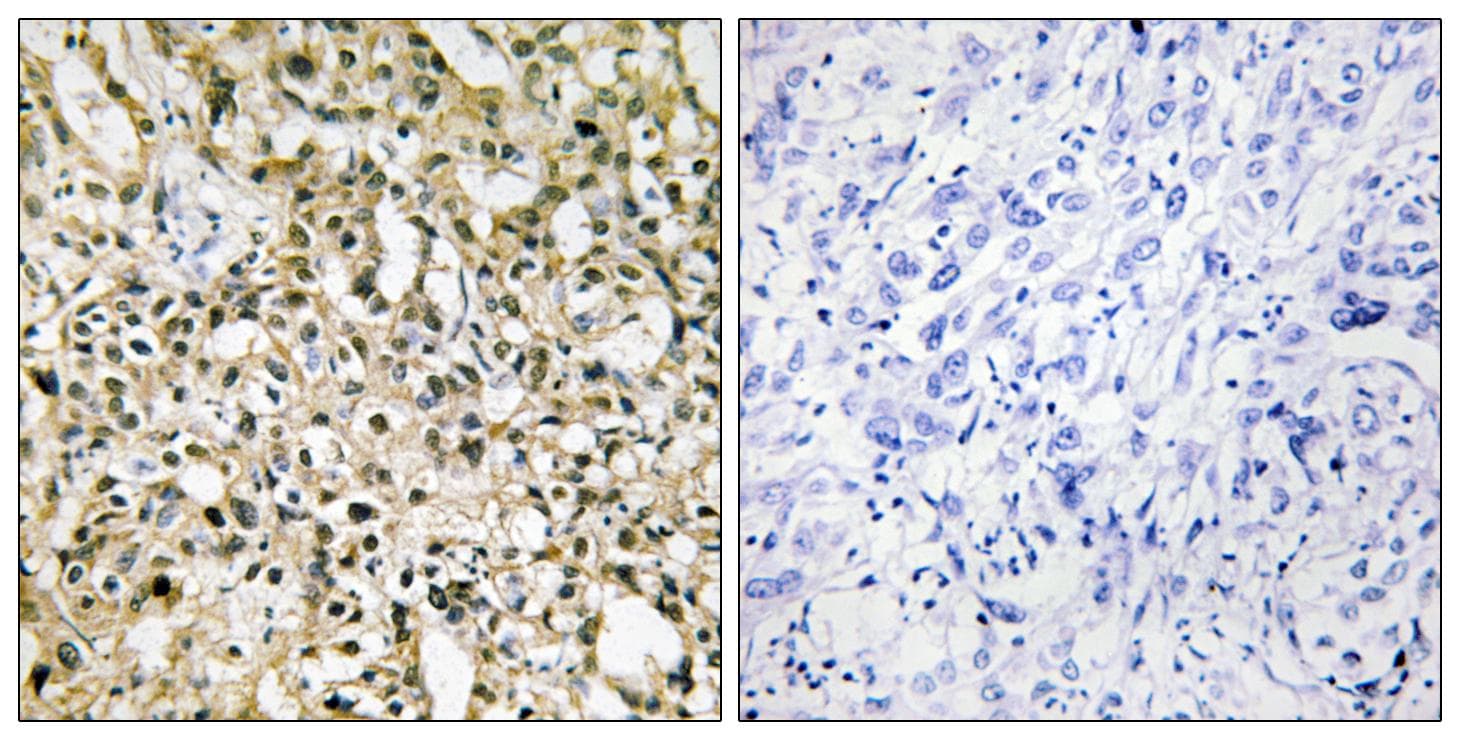 MYC / c-Myc Antibody