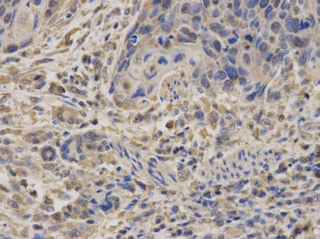 IHC-plus™ SDHA Antibody