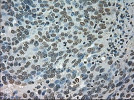 CTAG1B / NY-ESO-1 Antibody (clone OTI2B6)