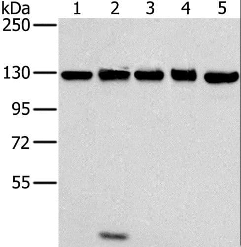 MATR3 / Matrin 3 Antibody