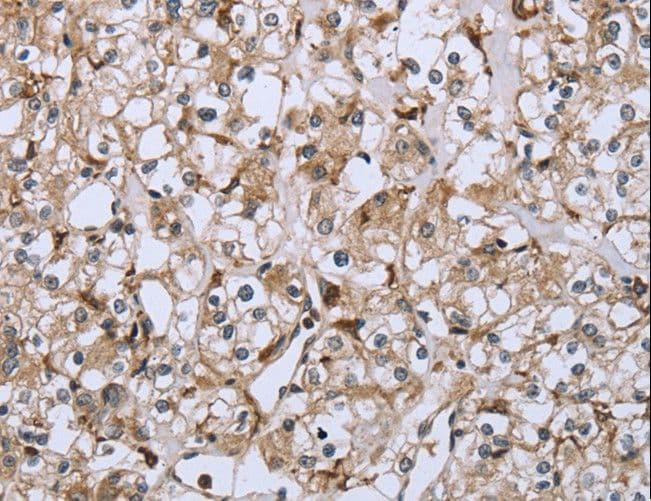 FCGR2 / CD32 Antibody
