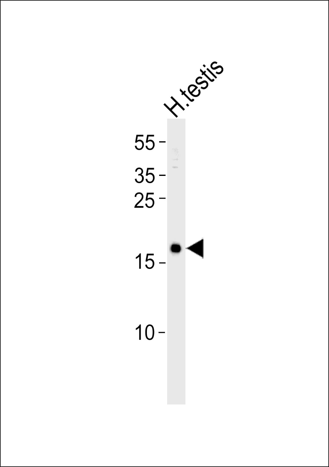 SPANXA2 Antibody (aa2-36)