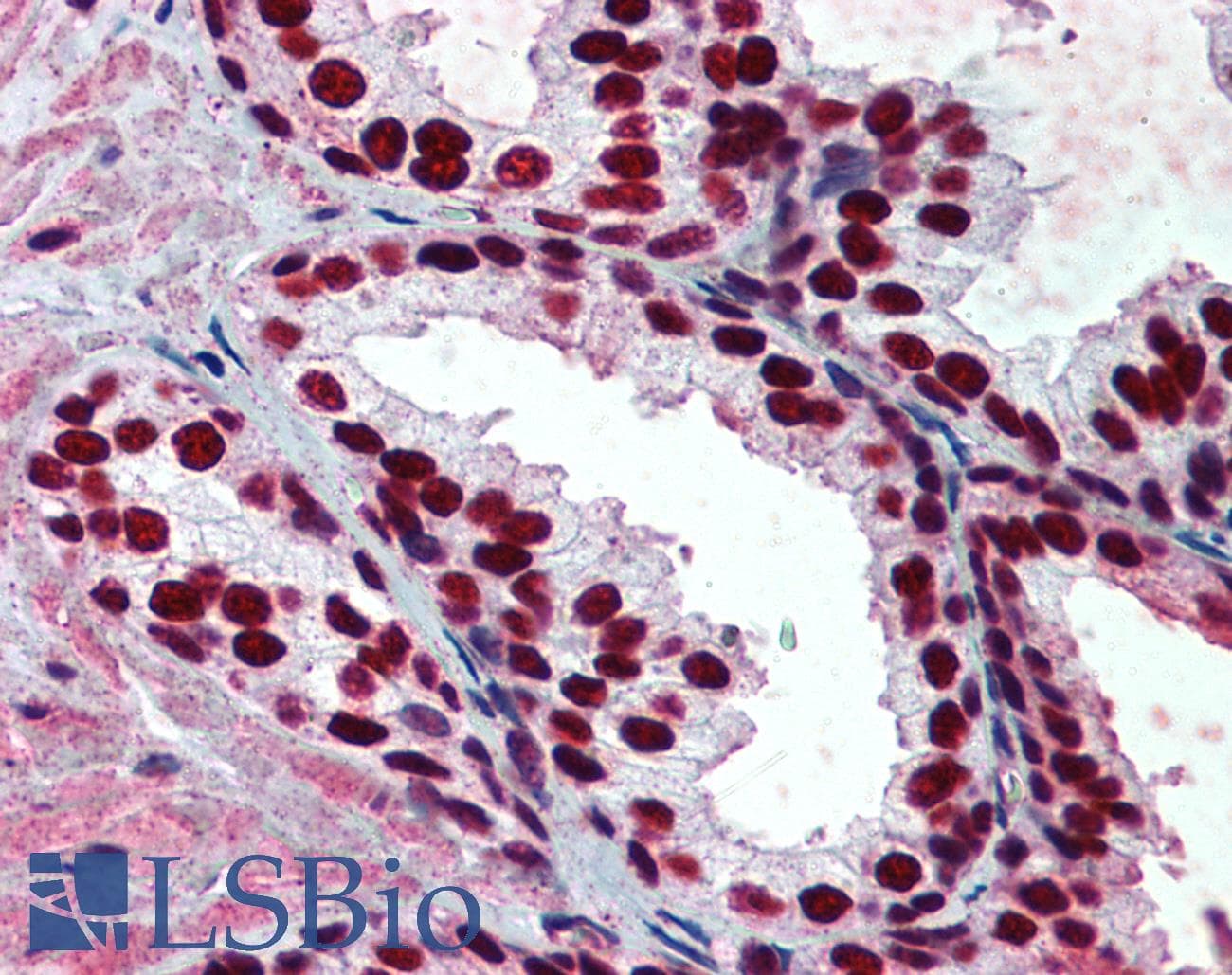 IHC-plus™ Monoclonal Mouse anti-Human PHAP1 / ANP32A Antibody (clone 2G11-4A5, IHC, IF, WB)