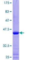 Human TXNL4B Protein (Recombinant GST)