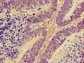 Polyclonal Rabbit anti-Human RPL28 / Ribosomal Protein L28 Antibody (Biotin, IHC, WB)