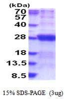 Human DCTN6 / Dynactin 6 Protein (Recombinant His)